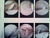 Avoiding Injury and Understanding the Rotator Cuff, Joins and Ligaments-img_20120425_130051.jpg