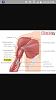 bicep tendonitis-forumrunner_20160514_222513.png