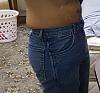 My experience with Flanks (love Handles) invasive liposuction-bad-pic.jpg