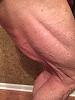 Click image for larger version. 

Name:	Side thigh 04242018.JPG 
Views:	69 
Size:	38.3 KB 
ID:	174001