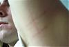 Stretch marks?-picture-035.jpg