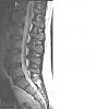 ongoing back pain Doc sust if you are still around-mri.jpg