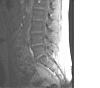 ongoing back pain Doc sust if you are still around-mri2.jpg