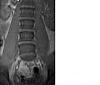 ongoing back pain Doc sust if you are still around-mri3.jpg