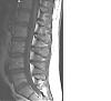 ongoing back pain Doc sust if you are still around-mri4.jpg