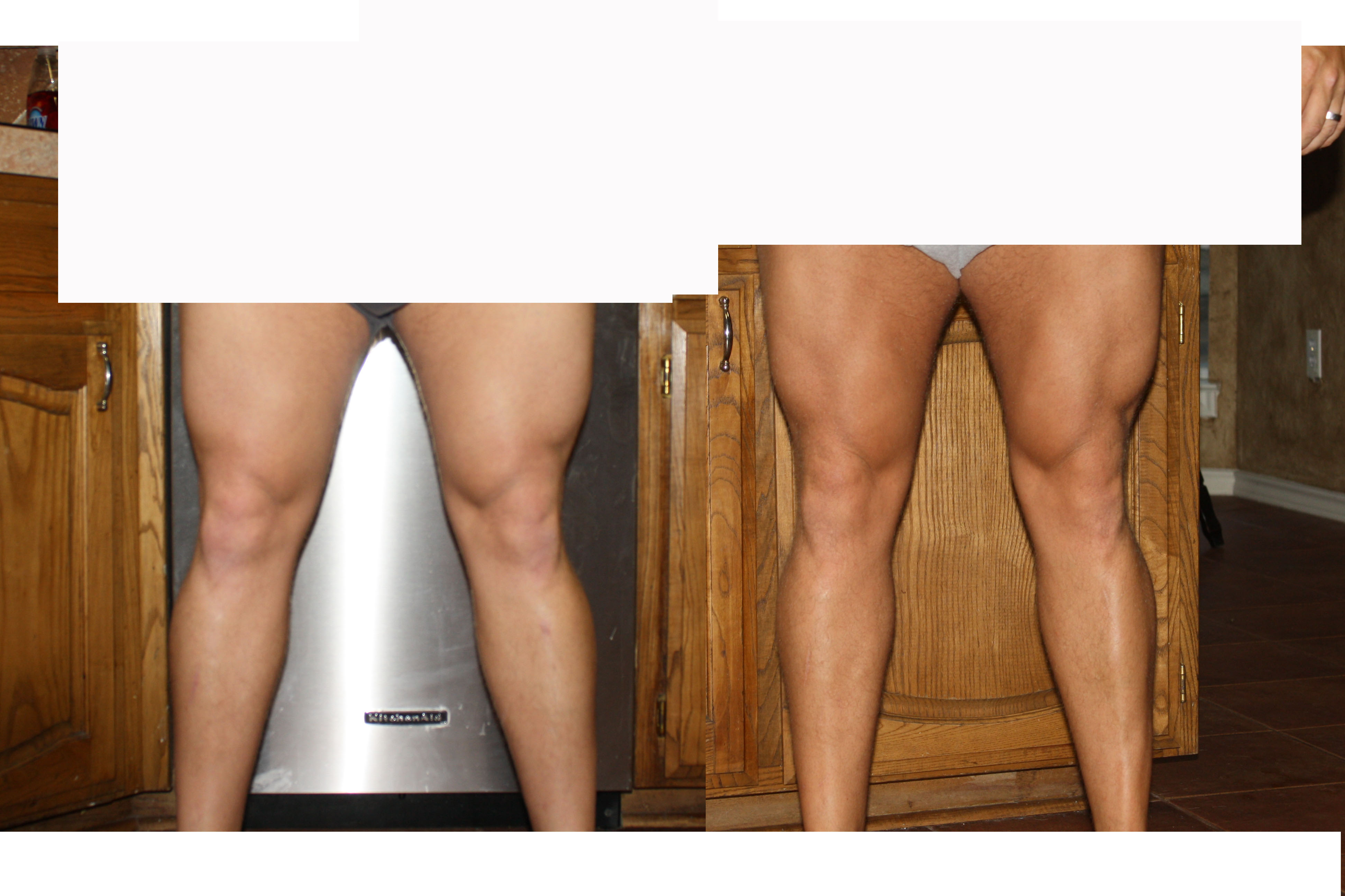 Legs before and after cycle pic.