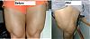&quot;Sort of&quot;  Before and after.-legs.jpg