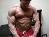 Are these before and after photos real??-vascularity.jpg