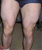 9 months time-frame before &amp; after pics-legs.jpg