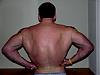 New pics After Chemo/ 19 months later-bigback.jpg