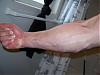 hows your forearms?-picture-184.jpg