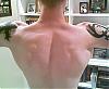 my back progress...6 weeks-20february2008back.jpg