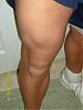 Check my leg progress after only 3 weeks-s7000243.jpg