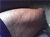 Are these before and after photos real??-leg-vascularity.jpg