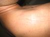 Stretch Marks?-img_5252.jpg