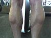 Are these before and after photos real??-ronnie_calves.jpg