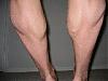 BD's Current Leg Routine-img_3131.jpg